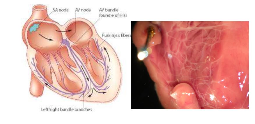 심장내의 Purkinje fibers 분포도와 실제 동물 좌심실의 Purkinje fiber왼쪽