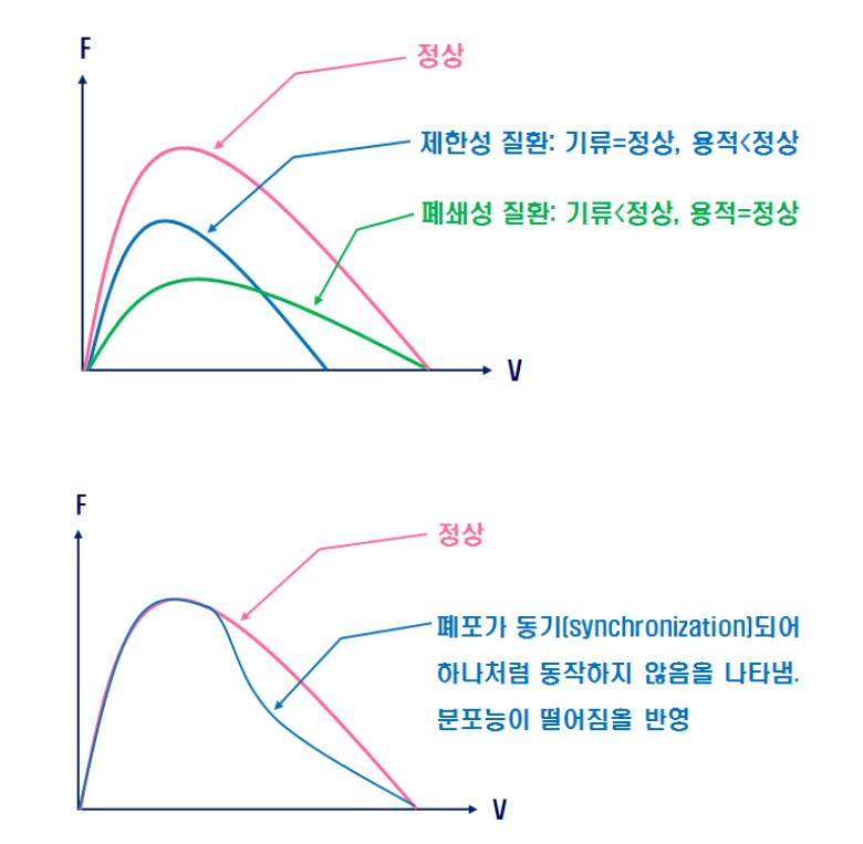 Flow - Volume LOOP 호흡기 질환의 유형 그래프