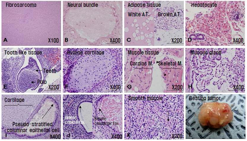 배아줄기세포에 대한 in vivo 종양형성능 시험의 발생종양에 대한 조직학적 평가