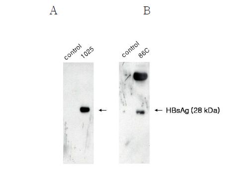 Western blot analysis of Hep B sAg expression of pLHBs.