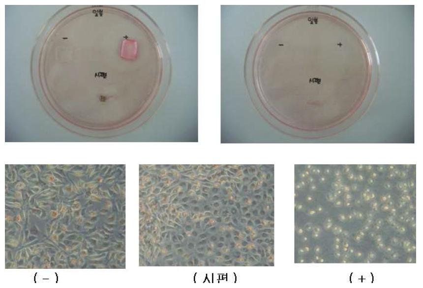 교정용 브라켓(Sample C)의 한천중층 시험 후 세포사진.