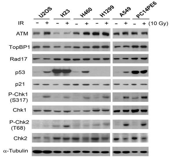 폐암 세포주에 in vitro radiation 조사 후 DNA damage checkpoint 관련 단백질의 발현 비교.