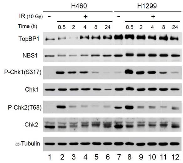 폐암 세포주에서 in vitro radiation에 의한 DNA damage response molecule의 활성 차이.