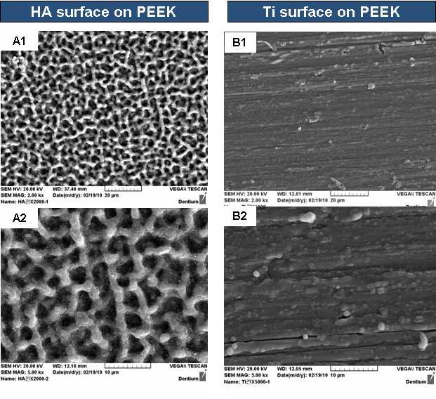 Bioactive surface on PEEK의 전자현미경 사진