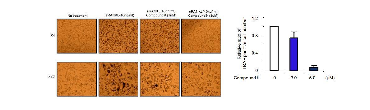 RANKL에 의한 mouse Raw264.7세포의 파골세포로 분화유도에 Compound K의 저해 기능을 측정함. mouse Raw264.7세포의 파골세포로의 분화는 Compound K 농도 의존적으로 감소함 (n = 2).