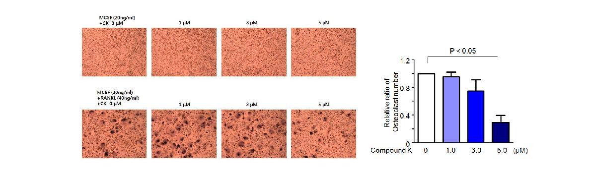 RANKL에 의한 인간 CD14+세포의 파골세포로 분화유도에 Compound K의 저해 기능을 측정함. 인간 CD14+세포의 파골세포로의 분화는 Compound K 농도 의존적으로 감소함 (n = 4).
