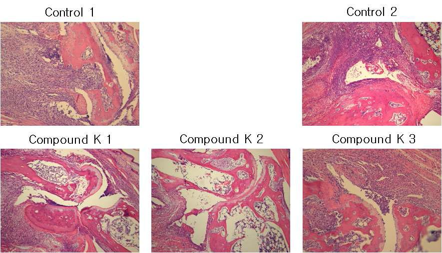 콜라겐 유도성 관절염 모델의 대표적 조직 소견. 대조군에서 심한 염증과 골파괴 가 관찰되는 반면에 Compound K 투여군에서 관절 조직내 염증의 감소와 골파괴가 감소함이 관찰됨 (x100).