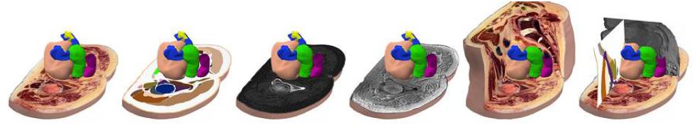 Female Pelvis Surface 3D Image with Sectioned Image(left), Segmented(middle) and CT, MR Image(right)