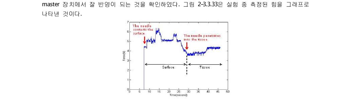 바늘 삽입 시 힘 측정 그래프