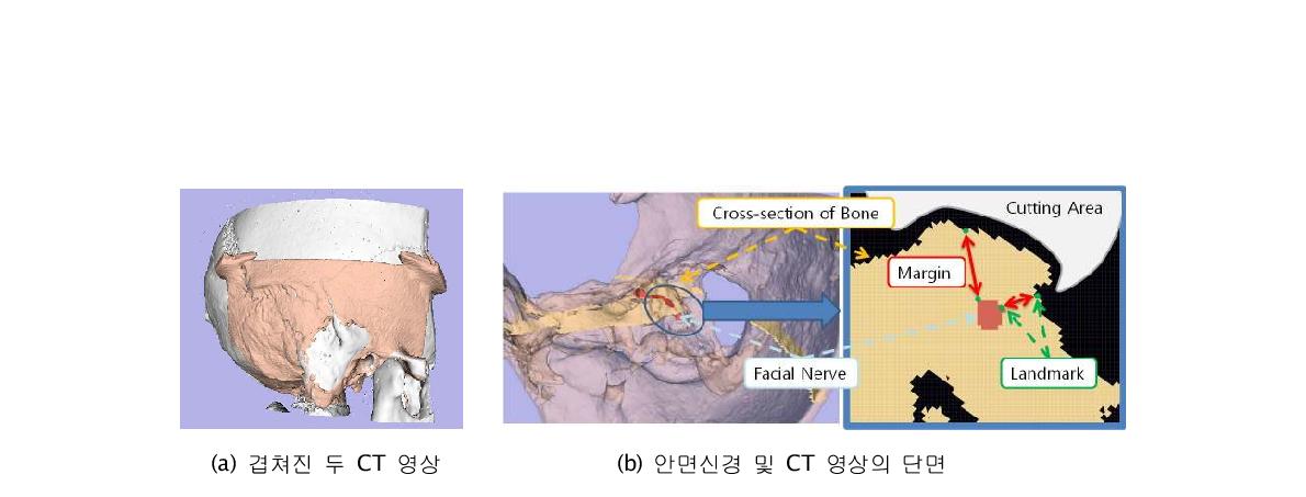 Landmark based Assessment method