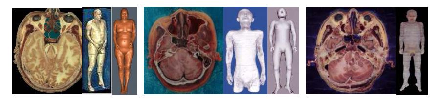 Visible Human (왼쪽), Chinese Visible Human (가운데), Visible Korean Human (오른쪽