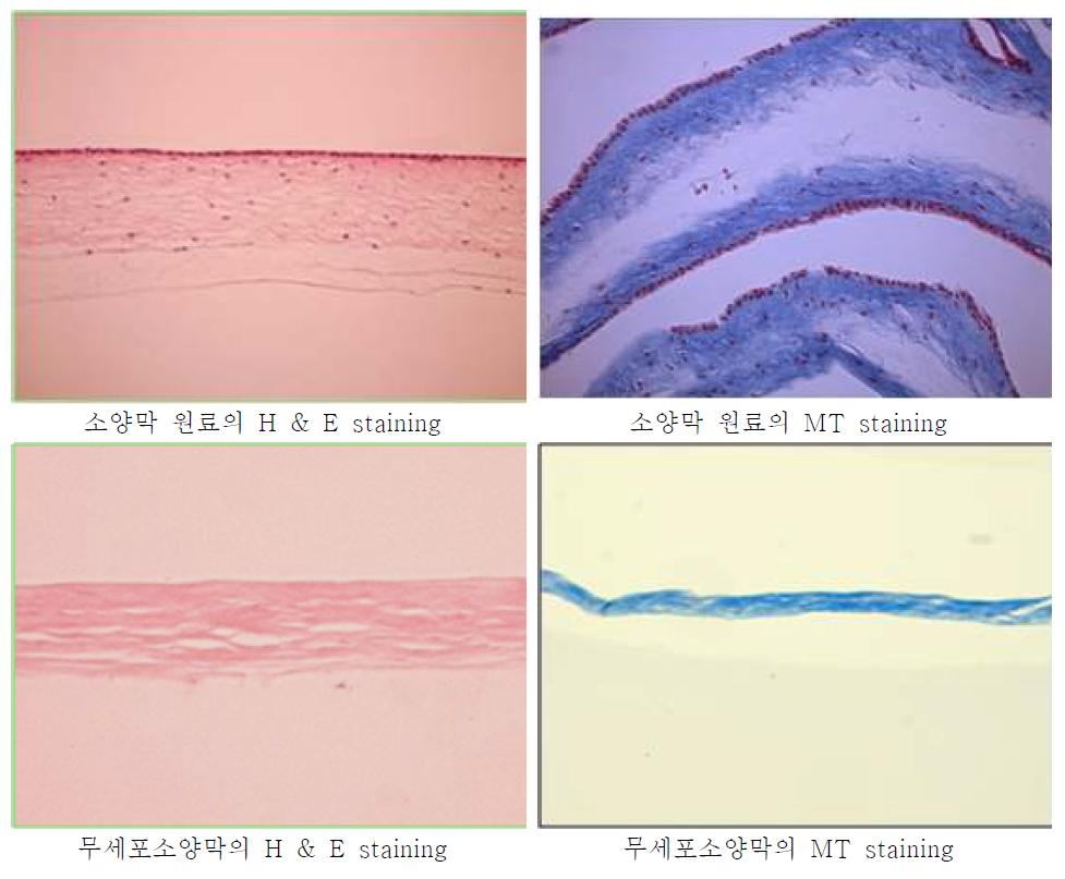 소양막 원료의 처리 전 후의 조직검사 사진