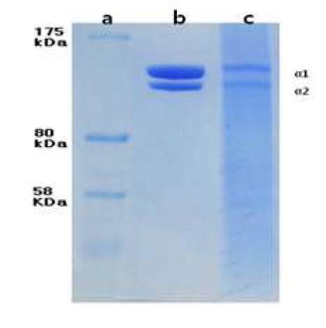 SDS-PAGE of solubilized AM. (a)marker, (b) collagen and (c) solubilized AM