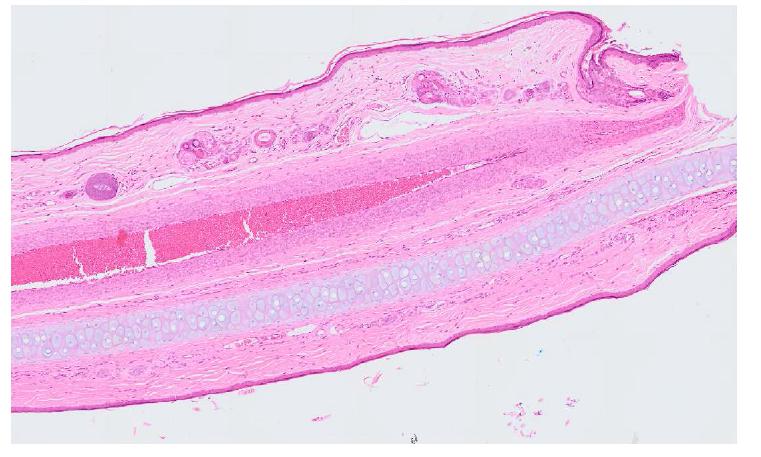 Histology of 5day post wounding as compared with the one of normal skin stained with H-E: Epidermal over proliferation (depicted as an arrow) and blood vessel dilation observed. Dermal collagen matrix arrangements showed some damage and restoration has not been progressed yet.