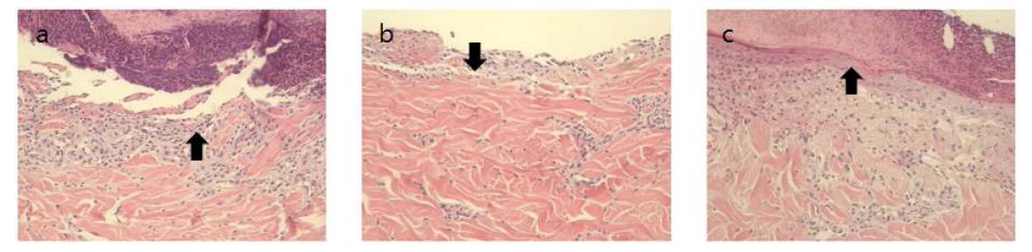 (a) PU (5-day post injury): 창상에 PU 드레싱 제제적용 후의 조직은 아직 손상된 부위의 재생이 이루어지지 않고 있으며 염증세포가 관찰이 되고 있다. (b) PU-collagen (5-day post injury): 손상된 피부의 재생이 이루어 지지 않고 염증세포가 관찰되고 염증단계인 것이 관찰된다. (c) PU-collagen/AM-2.5% (5-day post injury): 염증단계에서 재생단계가 진행되고 있으며 손상된 부위의 재생이 일어나고 있다.