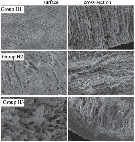 SEM images for each group show various sizes of pores and porechannels. As increasing water content of HAp slurry, the micropores were revealed certainly. (Magnification of surface images is x5,000, and that of cross-section images is x1,000).