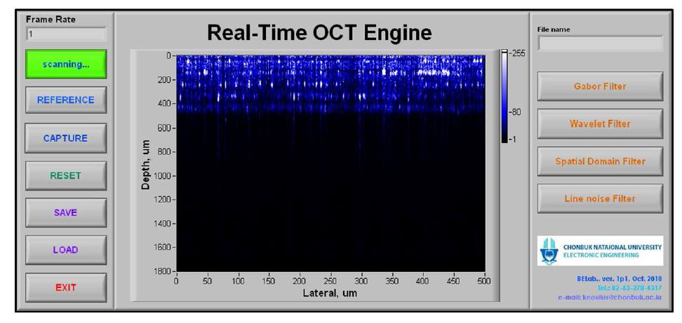 개발된 실시간 OCT 시스템 GUI.