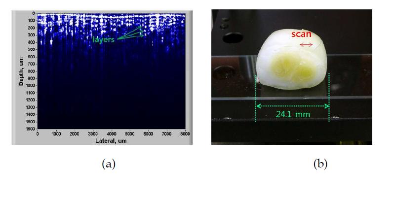 (a)양파에서 얻은 OCT 영상과 (b) 샘플.