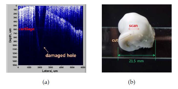 (a) chickens cartilage에서 얻은 OCT 영상과 (b) 샘플.