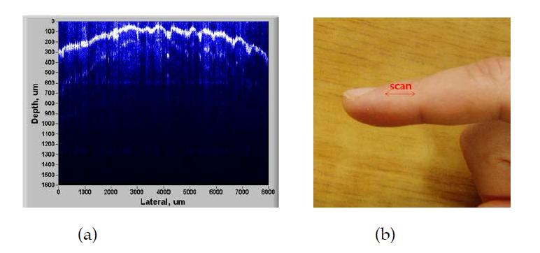 (a) 손가락에서 얻은 OCT 영상과 (b) 샘플.