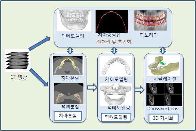 CT 영상분석을 위한 소프트웨어 구성 요소