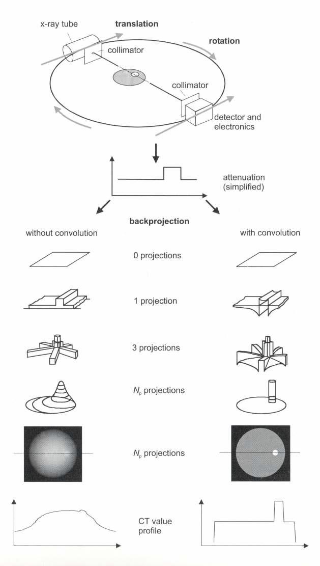 CBCT reconstruction에서 filtering 효과