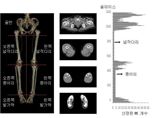 하지 부위별 자동 분할 결과