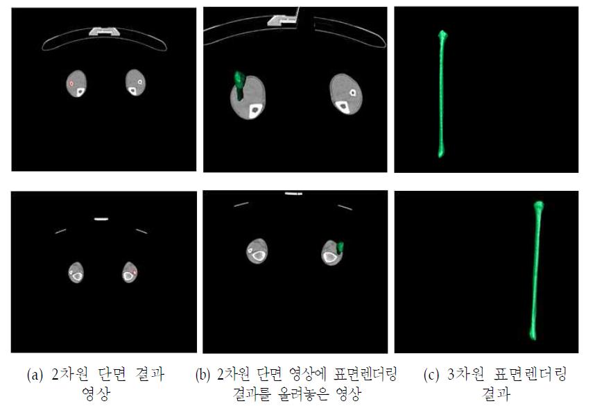 비골 3차원 자동 분할 결과