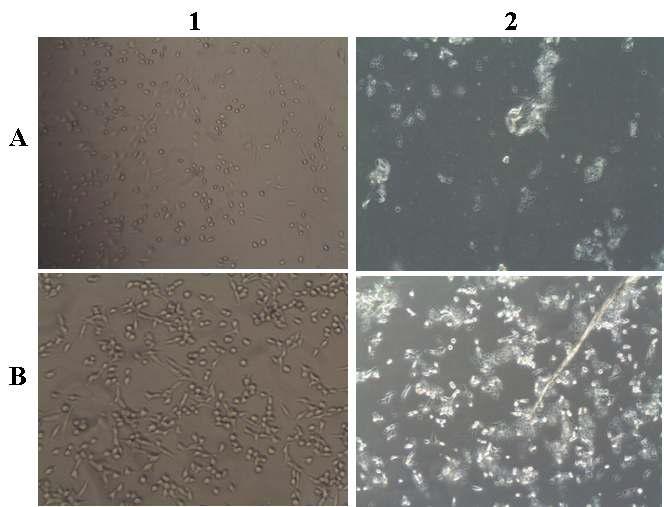 HY1-surfactin의 항암 활성