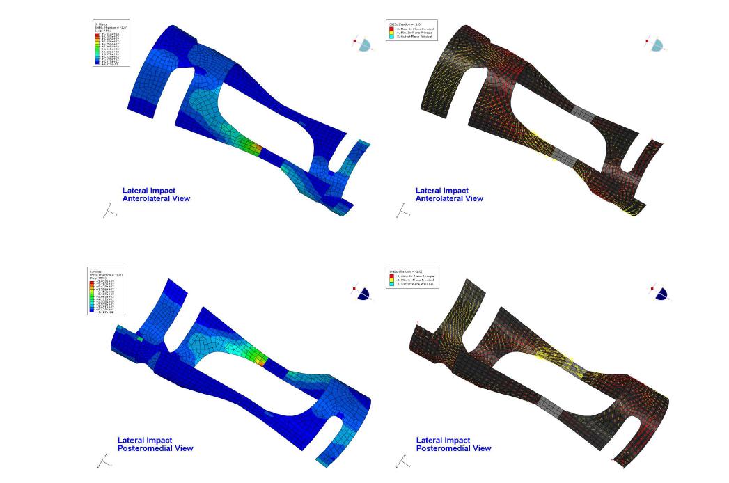 외측충격(Lateral Impact)시 von Mises 응력과 주응력 방향의 분포