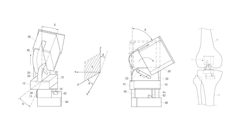 Mechanical femoral-tibio joint (patent pictures) made by this research group