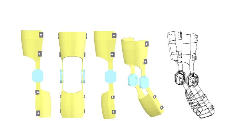 고탄성 섬유강화 복합재료로 제작될 무릎 보조기 개념도 (Medial compartment reinforced Knee orthosis using high flexible composite materials (carbon fiber reinforced polymer)