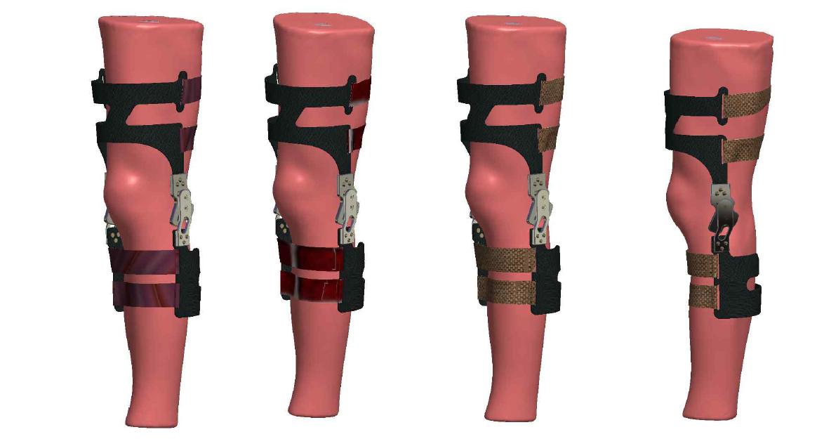 해부학적으로 일치하는 Knee brace Assembly