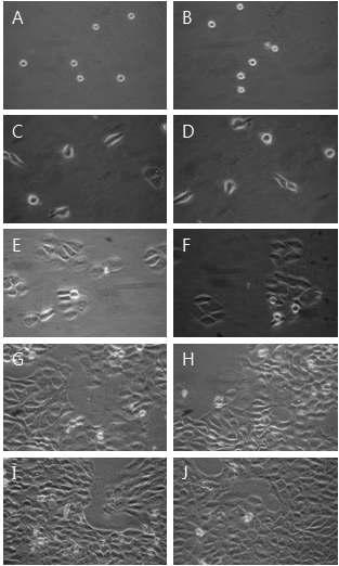 Morphological change by 25㎍/㎖ YW7758 for MTT assay on HaCAT as examined by inverted microscope(magnification, ×10) A : not treated with YW7758 for 0hr. B : not treated with YW7758 for 0hrs. C : not treated with YW7758 for 24hrs. D : treated with YW7758 25㎍/㎖ for 24hrs. E : not treated with YW7758 for 48hrs. F : treated with YW7758 25㎍/㎖ for 48hrs. G : not treated with YW7758 for 72hrs. H : treated with YW7758 25㎍/㎖ for 72hrs. I : not treated with YW7758 for 96hrs. J : treated with YW7758 25㎍/㎖ for 96hrs.