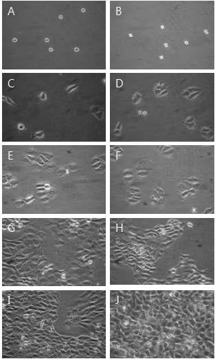 Morphological change by 100㎍/㎖ YW7758 for MTT assay on HaCAT as examined by inverted microscope(magnification, ×10) A : not treated with YW7758 for 0hr. B : not treated with YW7758 for 0hrs. C : not treated with YW7758 for 24hrs. D : treated with YW7758 100㎍/㎖ for 24hrs. E : not treated with YW7758 for 48hrs. F : treated with YW7758 100㎍/㎖ for 48hrs. G : not treated with YW7758 for 72hrs. H : treated with YW7758 100㎍/㎖ for 72hrs. I : not treated with YW7758 for 96hrs. J : treated with YW7758 100㎍/㎖ for 96hrs.