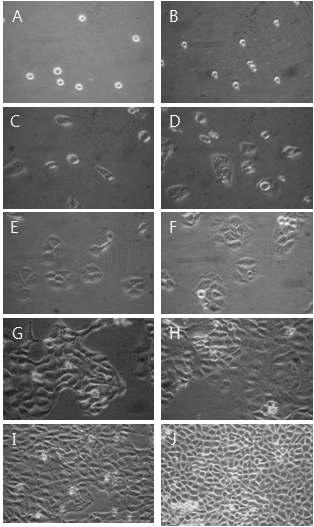 Morphological change by 25㎍/㎖ YW7760 for MTT assay on HaCAT as examined by inverted microscope(magnification, ×10) A : not treated with YW7760 for 0hr. B : not treated with YW7760 for 0hrs. C : not treated with YW7760 for 24hrs. D : treated with YW7760 25㎍/㎖ for 24hrs. E : not treated with YW7760 for 48hrs. F : treated with YW7760 25㎍/㎖ for 48hrs. G : not treated with YW7760 for 72hrs. H : treated with YW7760 25㎍/㎖ for 72hrs. I : not treated with YW7760 for 96hrs. J : treated with YW7760 25㎍/㎖ for 96hrs.