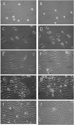 Morphological change by 50㎍/㎖ YW7760 for MTT assay on HaCAT as examined by inverted microscope(magnification, ×10) A : not treated with YW7760 for 0hr. B : not treated with YW7760 for 0hrs. C : not treated with YW7760 for 24hrs. D : treated with YW7760 25㎍/㎖ for 24hrs. E : not treated with YW7760 for 48hrs. F : treated with YW7760 25㎍/㎖ for 48hrs. G : not treated with YW7760 for 72hrs. H : treated with YW7760 25㎍/㎖ for 72hrs. I : not treated with YW7760 for 96hrs. J : treated with YW7760 25㎍/㎖ for 96hrs.