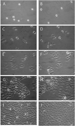 Morphological change by 100㎍/㎖ YW7760 for MTT assay on HaCAT as examined by inverted microscope(magnification, ×10) A : not treated with YW7760 for 0hr. B : not treated with YW7760 for 0hrs. C : not treated with YW7760 for 24hrs. D : treated with YW7760 25㎍/㎖ for 24hrs. E : not treated with YW7760 for 48hrs. F : treated with YW7760 25㎍/㎖ for 48hrs. G : not treated with YW7760 for 72hrs. H : treated with YW7760 25㎍/㎖ for 72hrs. I : not treated with YW7760 for 96hrs. J : treated with YW7760 25㎍/㎖ for 96hrs.