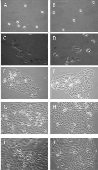 Morphological change by 25㎍/㎖ YC0110 for MTT assay on HaCAT as examined by inverted microscope(magnification, ×10) A : not treated with YC0110 for 0hr. B : not treated with YC0110 for 0hrs. C : not treated with YC0110 for 24hrs. D : treated with YC0110 25㎍/㎖ for 24hrs. E : not treated with YC0110 for 48hrs. F : treated with YC0110 25㎍/㎖ for 48hrs. G : not treated with YC0110 for 72hrs. H : treated with YC0110 25㎍/㎖ for 72hrs. I : not treated with YC0110 for 96hrs. J : treated with YC0110 25㎍/㎖ for 96hrs.