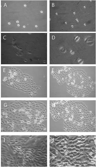 Morphological change by 50㎍/㎖ YC0110 for MTT assay on HaCAT as examined by inverted microscope(magnification, ×10) A : not treated with YC0110 for 0hr. B : not treated with YC0110 for 0hrs. C : not treated with YC0110 for 24hrs. D : treated with YC0110 25㎍/㎖ for 24hrs. E : not treated with YC0110 for 48hrs. F : treated with YC0110 25㎍/㎖ for 48hrs. G : not treated with YC0110 for 72hrs. H : treated with YC0110 25㎍/㎖ for 72hrs. I : not treated with YC0110 for 96hrs. J : treated with YC0110 25㎍/㎖ for 96hrs.