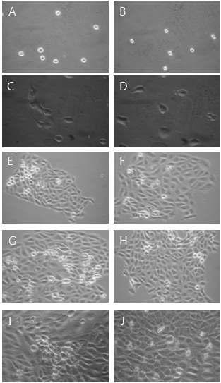 Morphological change by 100㎍/㎖ YC0110 for MTT assay on HaCAT as examined by inverted microscope(magnification, ×10) A : not treated with YC0110 for 0hr. B : not treated with YC0110 for 0hrs. C : not treated with YC0110 for 24hrs. D : treated with YC0110 25㎍/㎖ for 24hrs. E : not treated with YC0110 for 48hrs. F : treated with YC0110 25㎍/㎖ for 48hrs. G : not treated with YC0110 for 72hrs. H : treated with YC0110 25㎍/㎖ for 72hrs. I : not treated with YC0110 for 96hrs. J : treated with YC0110 25㎍/㎖ for 96hrs.