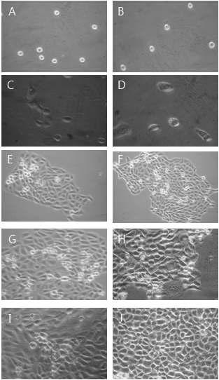 Morphological change by 25㎍/㎖ GABA for MTT assay on HaCAT as examined by inverted microscope(magnification, ×10) A : not treated with GABA for 0hr. B : not treated with GABA for 0hrs. C : not treated with GABA for 24hrs. D : treated with GABA 25㎍/㎖ for 24hrs. E : not treated with GABA for 48hrs. F : treated with GABA 25㎍/㎖ for 48hrs. G : not treated with GABA for 72hrs. H : treated with GABA 25㎍/㎖ for 72hrs. I : not treated with GABA for 96hrs. J : treated with GABA 25㎍/㎖ for 96hrs.