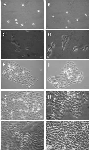 Morphological change by 50㎍/㎖ GABA for MTT assay on HaCAT as examined by inverted microscope(magnification, ×10) A : not treated with GABA for 0hr. B : not treated with GABA for 0hrs. C : not treated with GABA for 24hrs. D : treated with GABA 25㎍/㎖ for 24hrs. E : not treated with GABA for 48hrs. F : treated with GABA 25㎍/㎖ for 48hrs. G : not treated with GABA for 72hrs. H : treated with GABA 25㎍/㎖ for 72hrs. I : not treated with GABA for 96hrs. J : treated with GABA 25㎍/㎖ for 96hrs.