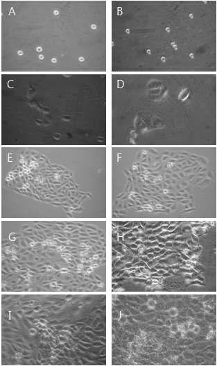 Morphological change by 100㎍/㎖ GABA for MTT assay on HaCAT as examined by inverted microscope(magnification, ×10) A : not treated with GABA for 0hr. B : not treated with GABA for 0hrs. C : not treated with GABA for 24hrs. D : treated with GABA 25㎍/㎖ for 24hrs. E : not treated with GABA for 48hrs. F : treated with GABA 25㎍/㎖ for 48hrs. G : not treated with GABA for 72hrs. H : treated with GABA 25㎍/㎖ for 72hrs. I : not treated with GABA for 96hrs. J : treated with GABA 25㎍/㎖ for 96hrs.