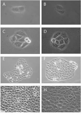 Morphological change by 100㎍/㎖ YW7758 for cell growth on HaCAT as examined by inverted microscope(magnification, ×10) A : not treated with YW7758 for 24hr. B : not treated with YW7758 for 24hrs. C : not treated with YW7758 for 48hrs. D : treated with YW7758 for 48hrs. E : not treated with YW7758 for 96hrs. F : treated with YW775 for 96hrs. G : not treated with YW7758 for 144hrs. H : treated with YW7758 for 144hrs.