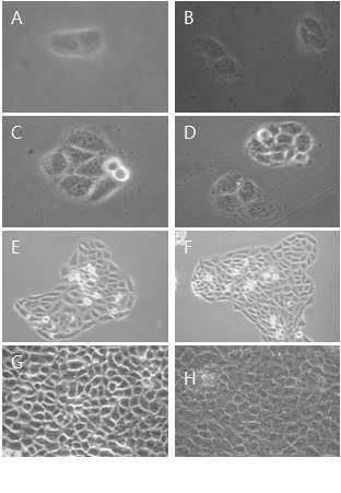 Morphological change by 100㎍/㎖ YC0110 for cell growth on HaCAT as examined by inverted microscope(magnification, ×10) A : not treated with YC0110 for 24hr. B : not treated with YC0110 for 24hrs. C : not treated with YC0110 for 48hrs. D : treated with YC0110 for 48hrs. E : not treated with YC0110 for 96hrs. F : treated with YC0110 for 96hrs. G : not treated with YC0110 for 144hrs. H : treated with YC0110 for 144hrs.