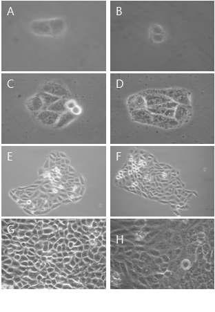 Morphological change by 100㎍/㎖ GABA for cell growth on HaCAT as examined by inverted microscope(magnification, ×10) A : not treated with GABA for 24hr. B : not treated with GABA for 24hrs. C : not treated with GABA for 48hrs. D : treated with GABA for 48hrs. E : not treated with GABA for 96hrs. F : treated with GABA for 96hrs. G : not treated with GABA for 144hrs. H : treated with GABA for 144hrs.