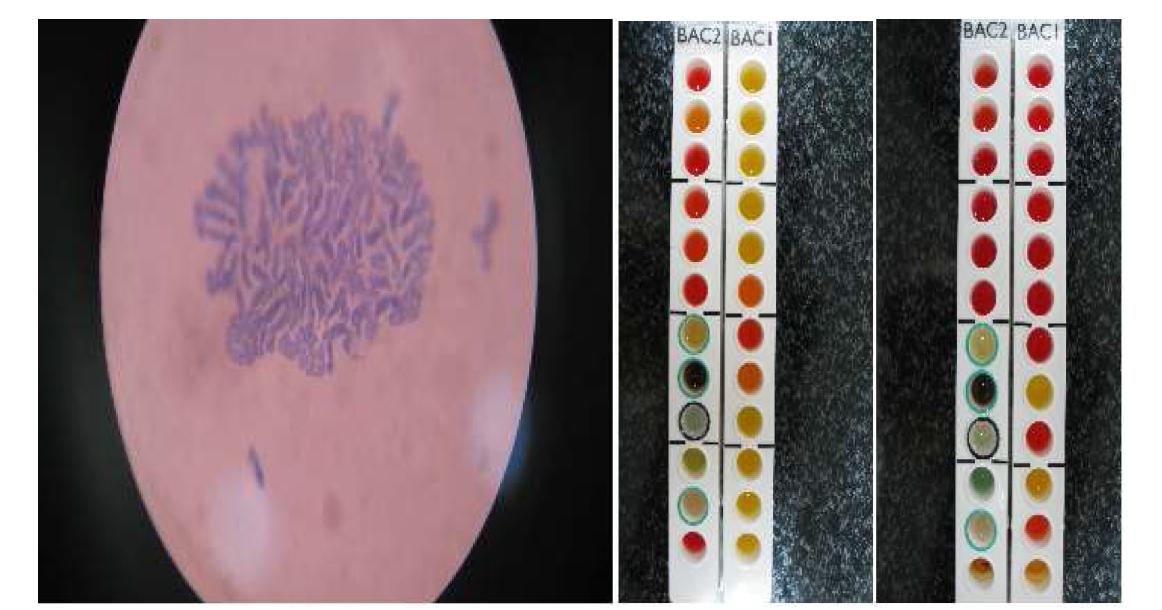 Gram Staining and Microgen Bacillus IDTM test.