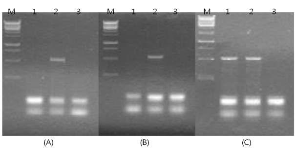 Agarose gel electrophoresis of PCR-generated amplification B. cereus HblA segments