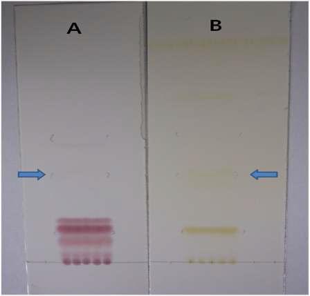 Thin-layer chromatography (TLC) of the antagonistic substanceproduced by B. subtilis BY08.